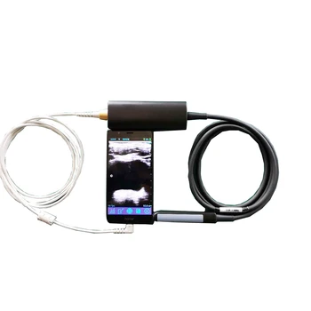 64-elemental ultrazvučna sonda USG za mobilne uređaje IOS i Android - Slika 2  